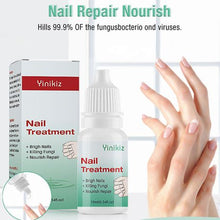 Load image into Gallery viewer, Nail Anti-Fungal Treatment - Nail &amp; Cuticle Treatment - 10ml
