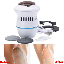 Load image into Gallery viewer, Thethi Vacuum Callus Remover Bundle
