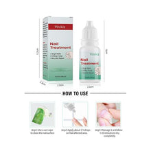 Load image into Gallery viewer, Nail Anti-Fungal Treatment - Nail &amp; Cuticle Treatment - 10ml
