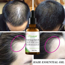 Load image into Gallery viewer, Anti- Hair Loss Oil x 30g
