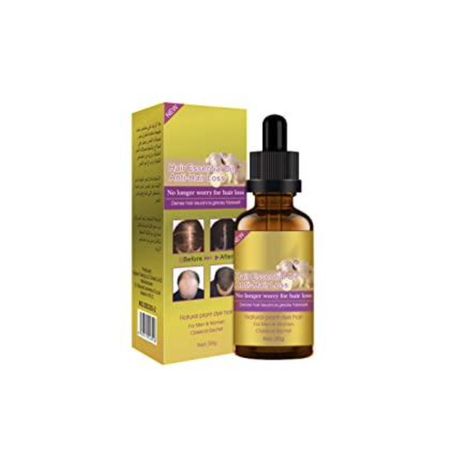 Anti Hair Loss Oil with Ginger Extract Buy Online in Zimbabwe thedailysale.shop