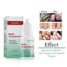 Load image into Gallery viewer, Nail Anti-Fungal Treatment - Nail &amp; Cuticle Treatment - 10ml
