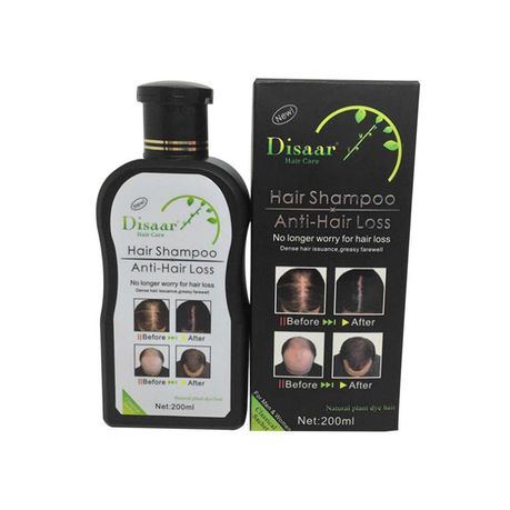 Anti-Hair Loss Shampoo Buy Online in Zimbabwe thedailysale.shop